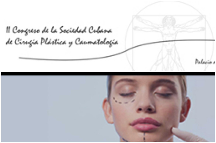 Asocian en Cuba rejuvenecimiento cervicofacial a la perfección Asocian en Cuba rejuvenecimiento cervicofacial a la perfección