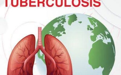 Día Mundial de la Tuberculosis, una jornada a favor de la seguridad sanitaria