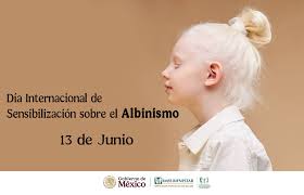 Día de Sensibilización sobre el albinismo, en Las Tunas voluntades desde la atención asistencial